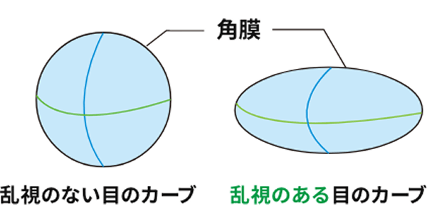 乱視のない目のカーブと乱視のある目のカーブ